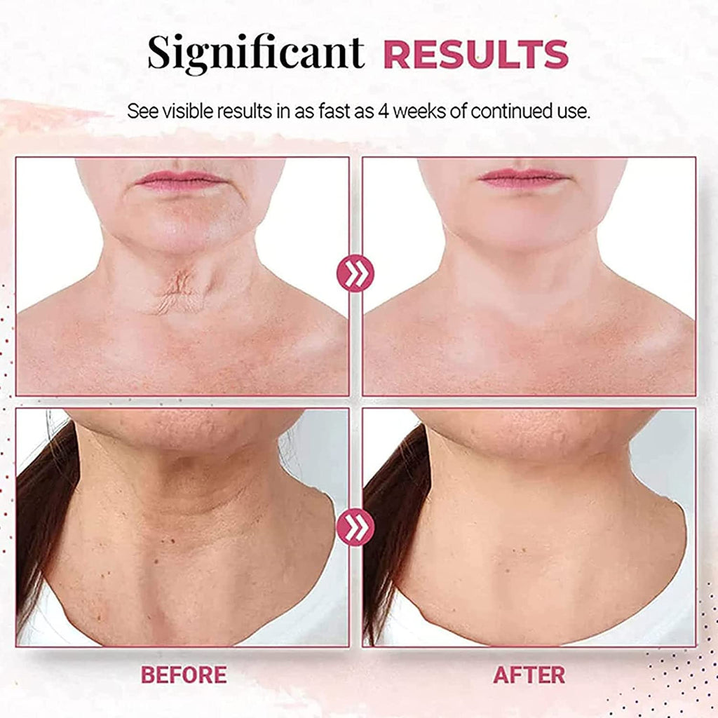 Skin Lightening and Firming Neck Cream