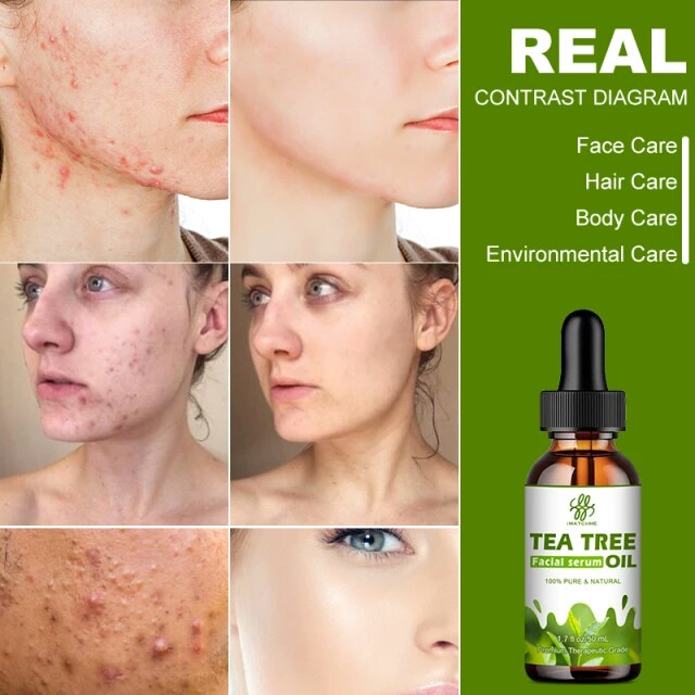 FATAZEN Organic Tea Tree Serum